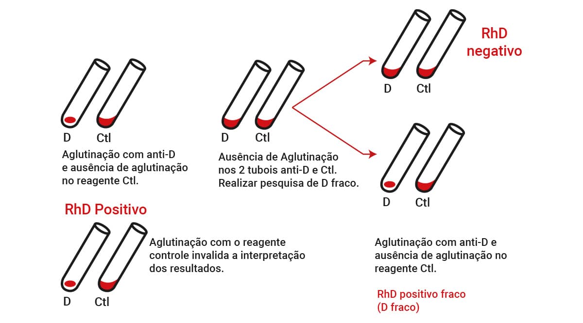 Exames pré-transfusionais e acompanhamento transfusional