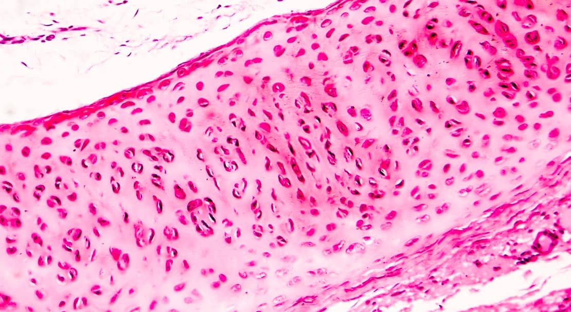 Histologia do tecido cartilaginoso ósseo e muscular