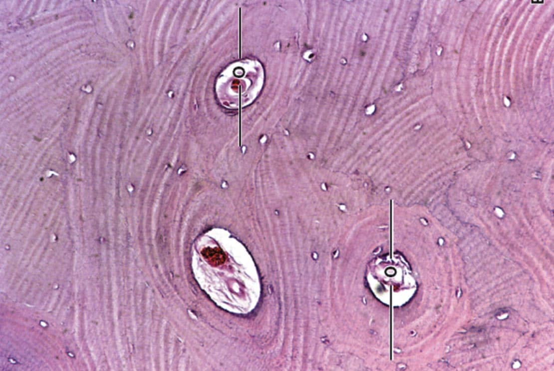 Histologia Do Tecido Cartilaginoso Sseo E Muscular